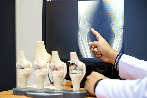 best knee replacement surgeon in chembur