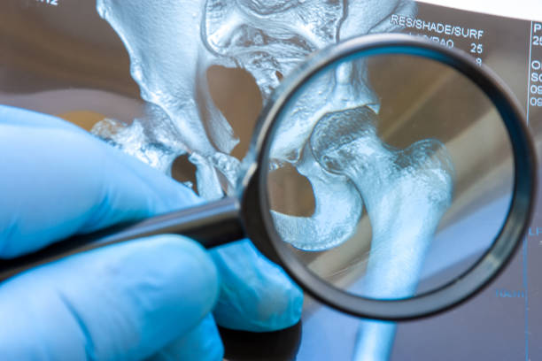 doctor for hip surgery in chembur
